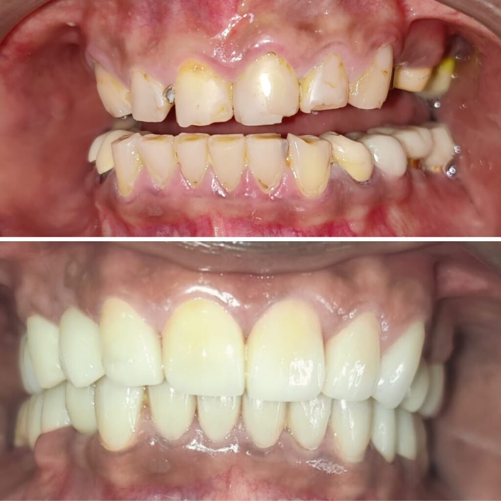 dental services in mumbai